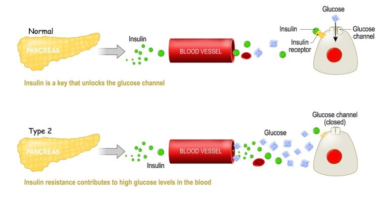 Wat is insuline resistentie en hoe kom je er van af? 5 tips!