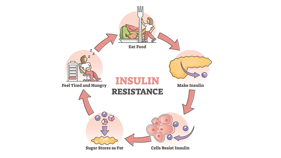 insulineresistentie symptomen